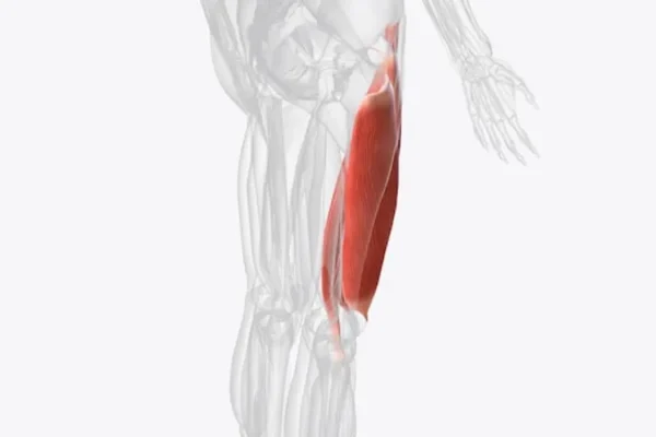 fibrosis del musculo isquiotibial