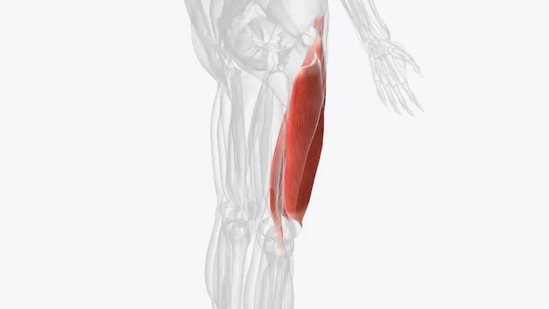 fibrosis del musculo isquiotibial