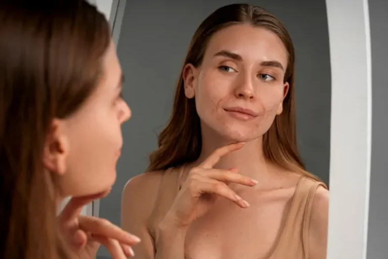 Cicatrices y cicatrización de la piel, entendiendo el proceso natural