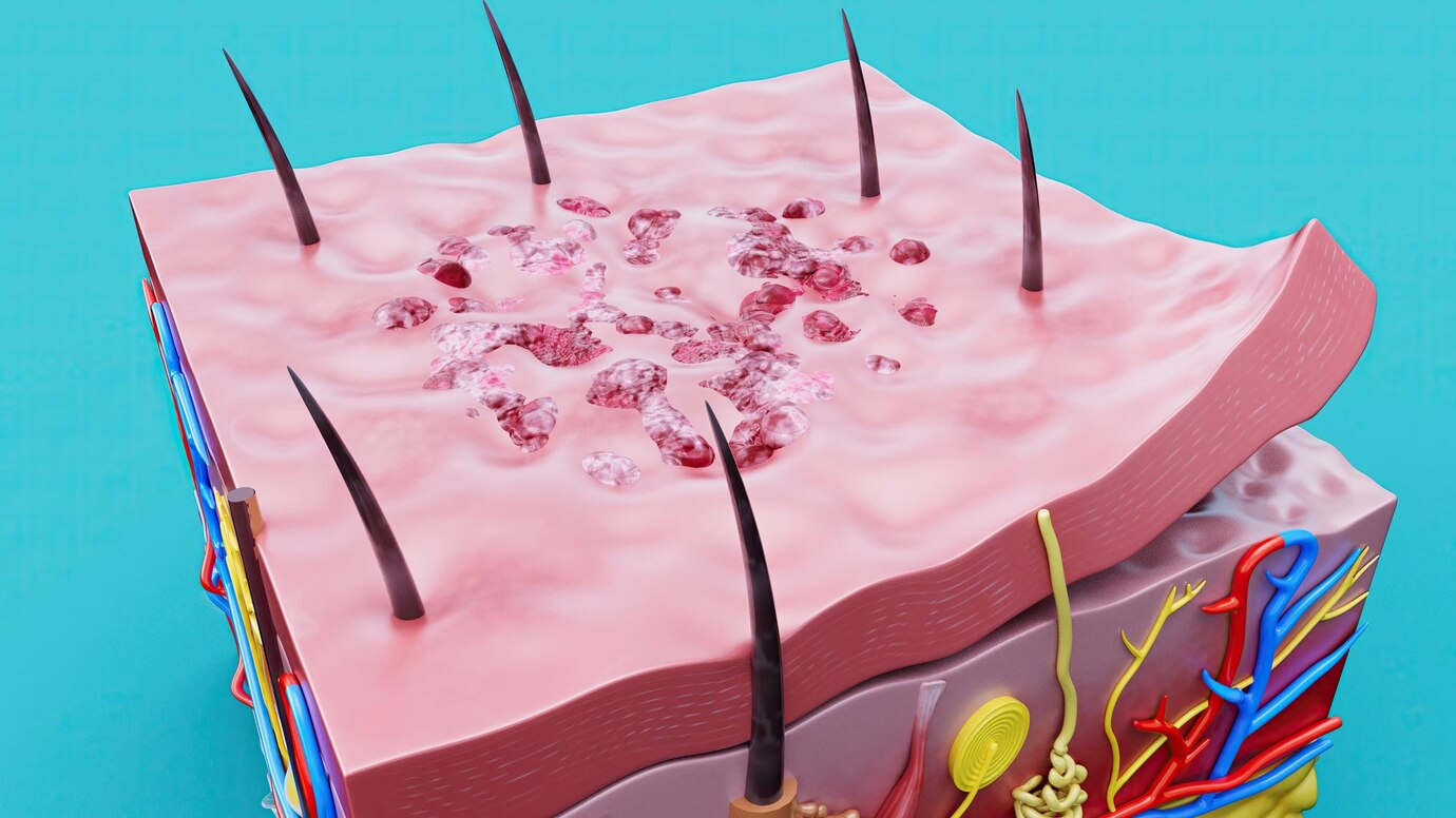 Dermatitis y jacksonville.