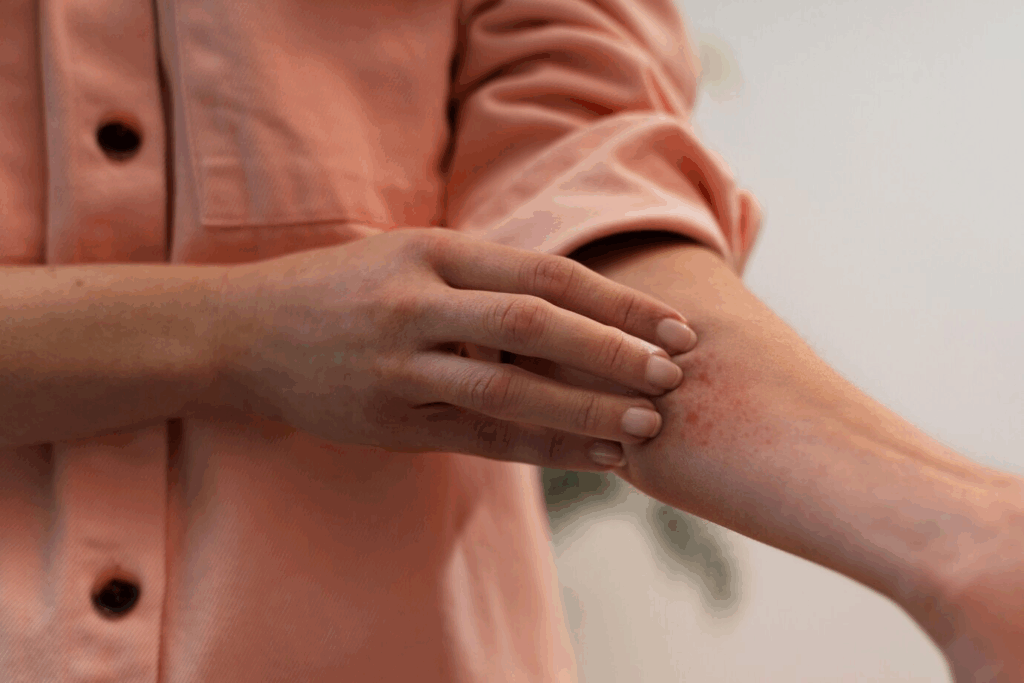 Dermatitis: Los diferentes tipos y cómo tratarlos adecuadamente 2 Dermatitis y jacksonville.