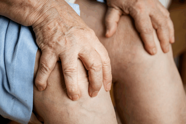 Artritis reumatoide en miami